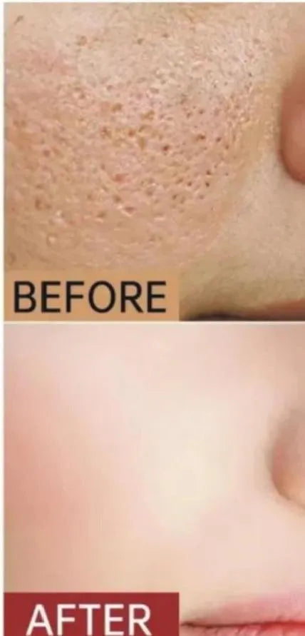 Whitening Glowing Cream for All Skin Types 7 Days