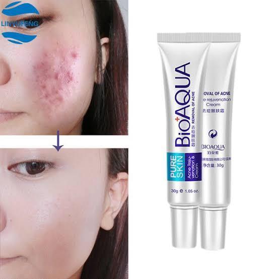 Premium Acne Removal Cream 30g All Skin Types