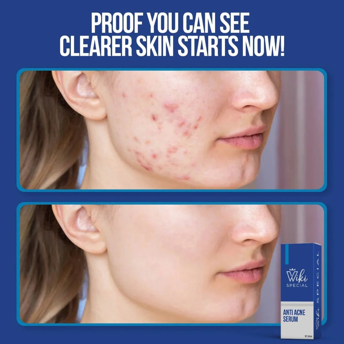 clear skin