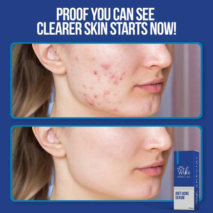 clear skin